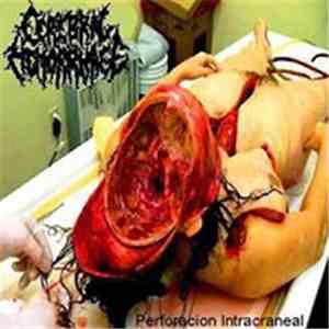 Cerebral Hemorrhage  - Perforacion Intracranea download free